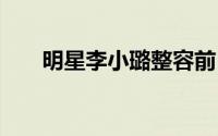 明星李小璐整容前 明星整容前后对比