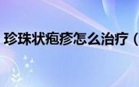 珍珠状疱疹怎么治疗（颗粒珍珠状疱疹简介）