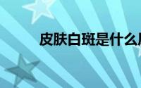 皮肤白斑是什么原因（皮肤白班）