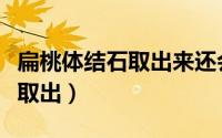 扁桃体结石取出来还会长吗（扁桃体结石如何取出）